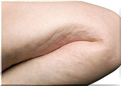 6 exercises to effectively fight cellulite