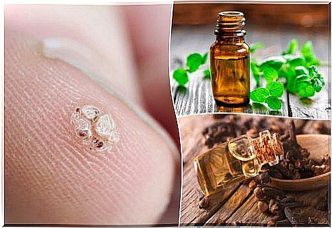 7 essential oils that will help you get rid of warts