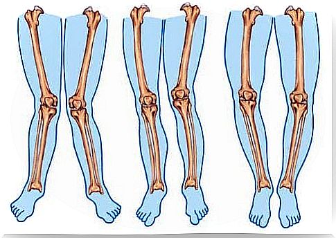 Different types of legs.