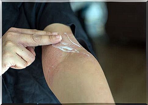 Person applies topical corticosteroids