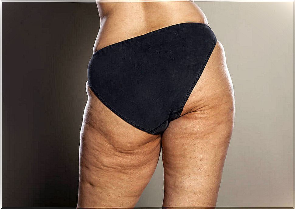 Counteract cellulite