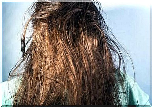 A woman with oily and tousled hair.