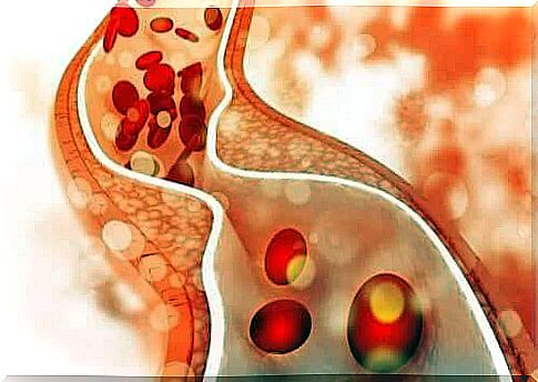 cholesterol in the body