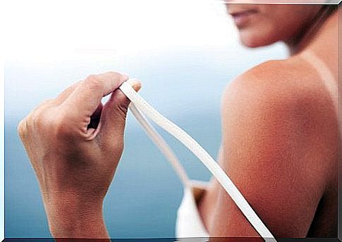 Treat sunburn with these 5 natural methods