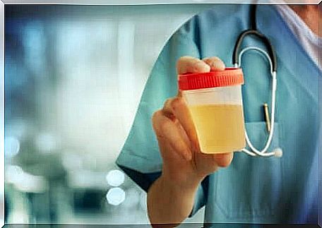 A medical professional holding a urine sample.