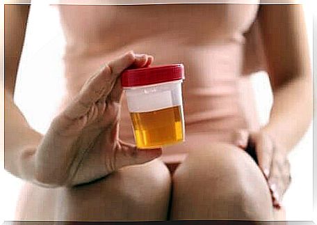 A patient holding a urine sample.