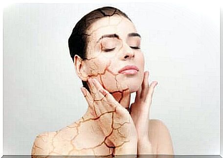 Woman with dry skin touches her face.